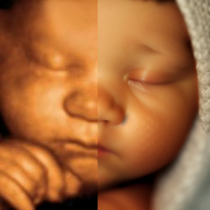 AI RealView Ultrasound: Transform Ultrasound Image to Realistic Photos (Digital File)