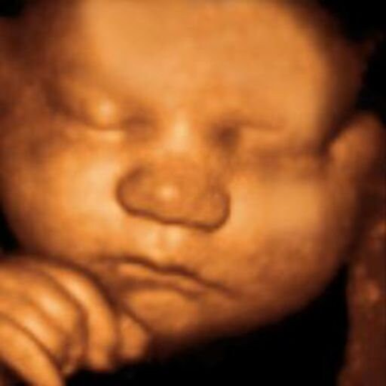 AI RealView Ultrasound: Transform Ultrasound Image to Realistic Photos (Digital File)