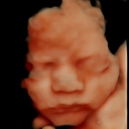 AI RealView Ultrasound: Transform Ultrasound Image to Realistic Photos (Digital File)